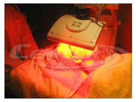PDT bőrmegújító gép vörös LED fény